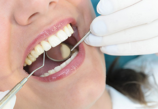虫歯は早期発見・早期治療が大切です